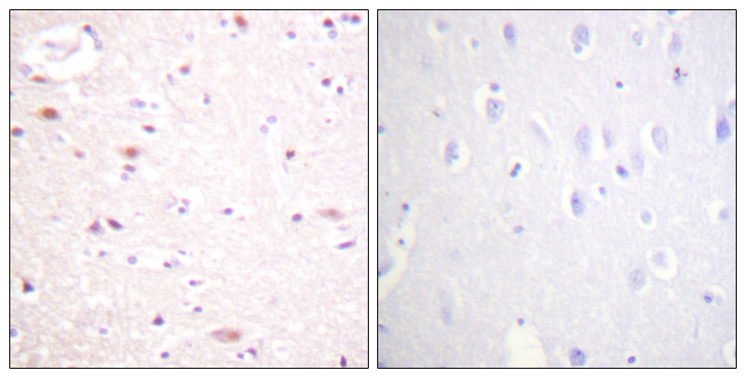 APC6 / CDC16 Antibody (phospho-Ser560)