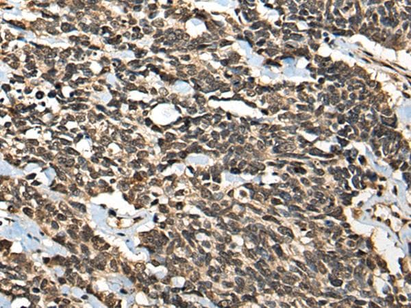 Polyclonal Rabbit anti-Human MICU1 / CBARA1 Antibody (IHC)