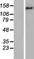 BRIP1 / BACH1 Protein (Over-Expression Lysate Myc-DDK (Flag))