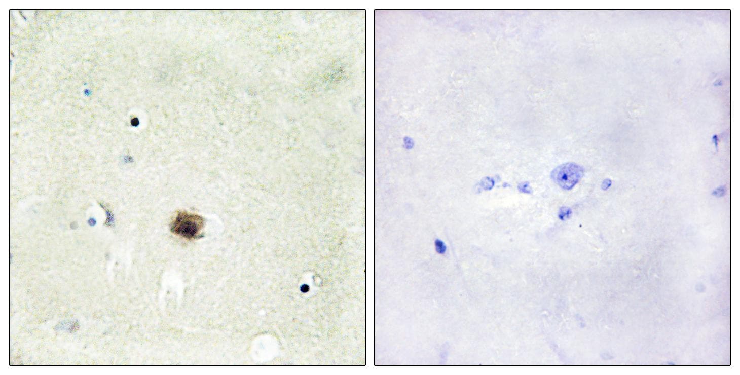 CSRP1 Antibody
