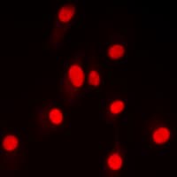 Polyclonal Rabbit anti-Human NFKB2 Antibody (C-Terminus, IHC, IF, WB)