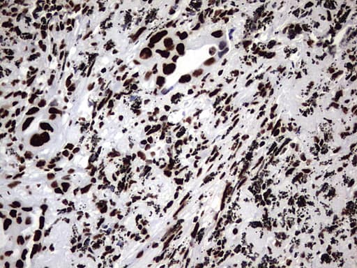 HNRPM / HNRNPM Antibody (aa1-261, clone OTI4C9)