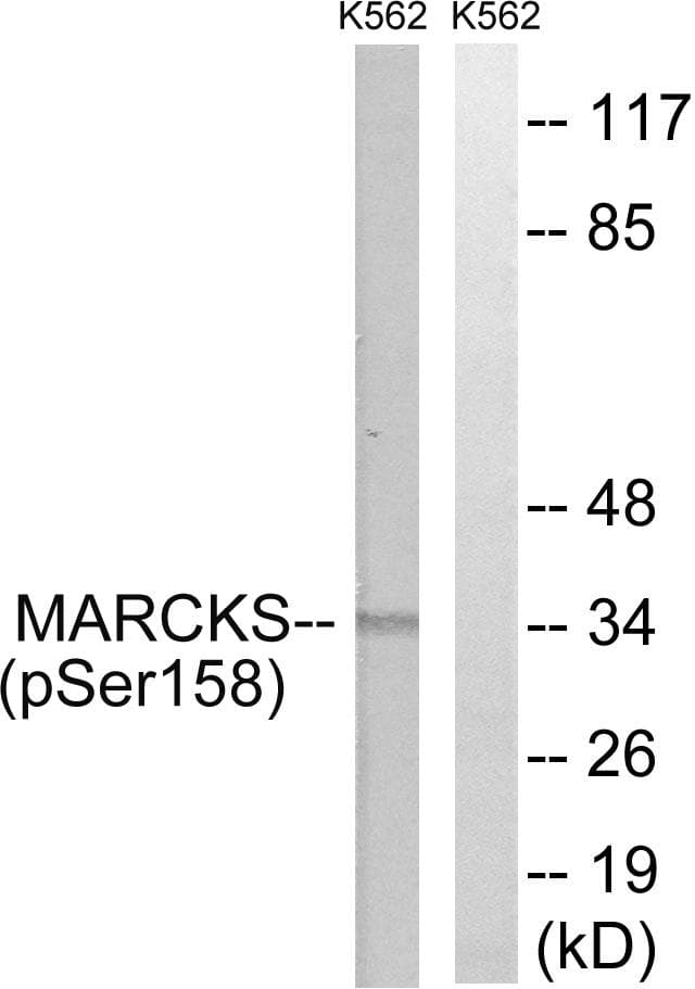 MARCKS Antibody (phospho-Ser158)
