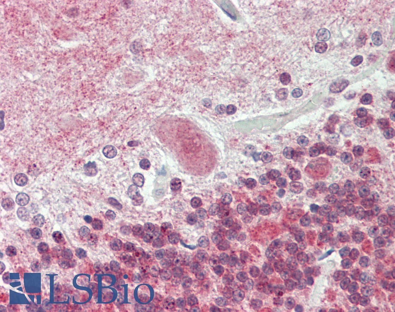 ATP13A2 Antibody (Internal, Biotin)