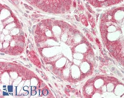 IHC-plus™ HMT / HNMT Antibody