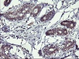 Monoclonal Mouse anti-Human MAP2K3 / MEK3 / MKK3 Antibody (clone OTI1H3, IHC, WB)