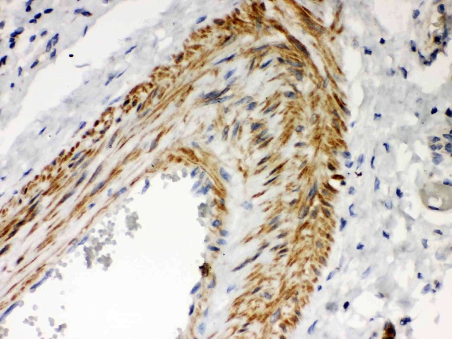 PRKCI / PKC Iota Antibody (aa21-214)