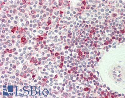 PSAT1 Antibody (aa99-148)