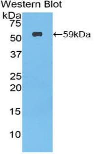 PODXL / Podocalyxin Antibody (aa220-463, Biotin)