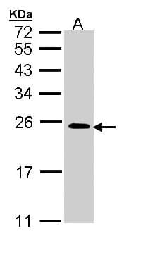 TC21 / RRAS2 Antibody (aa1-204)