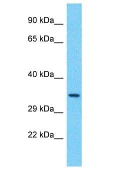 PPTC7 Antibody (aa230-279)