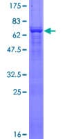 Human ACTG2 Protein (Recombinant GST)