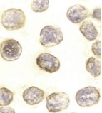 DAXX Antibody
