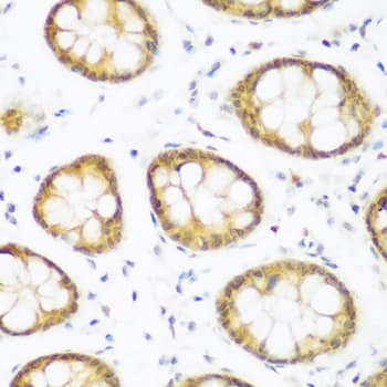 Polyclonal Rabbit anti-Human BRD9 Antibody (IHC, WB)