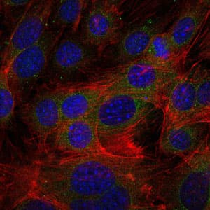 FGG / Fibrinogen Gamma Antibody (clone 4H9)