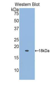 RBP5 Antibody (aa2-135)