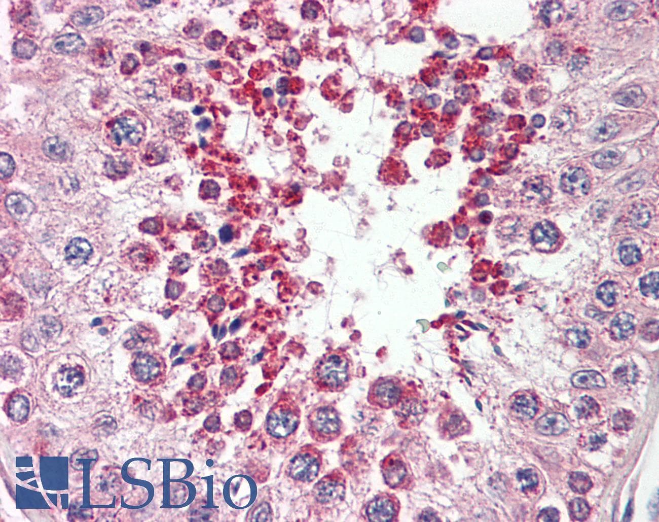 IHC-plus™ SIMPL / IRAK1BP1 Antibody