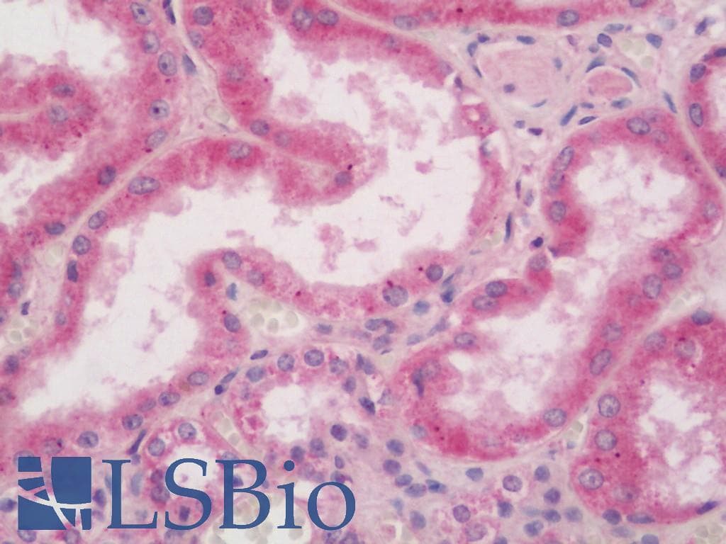 IHC-plus™ TRB3 / TRIB3 Antibody