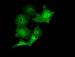 MOBKL2B / MOB3B Antibody (clone OTI1G1)