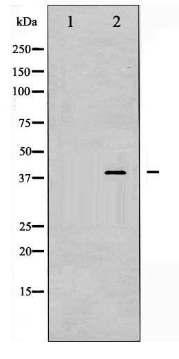 Polyclonal Rabbit anti-Human PRKAB1 / AMPK Beta 1 Antibody (phospho-Ser181, IHC, WB)