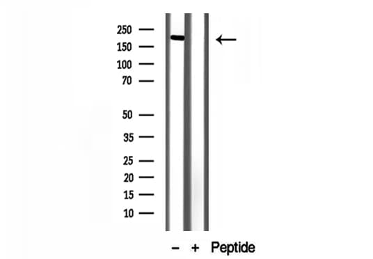 KIAA0191 / ZCCHC11 Antibody