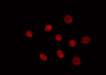 Polyclonal Rabbit anti-Human TBX18 Antibody (IF, WB)