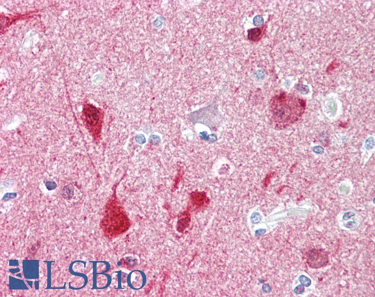 IHC-plus™ CRYAB / Alpha B Crystallin Antibody (aa10-59)