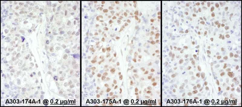 HSF1 Antibody (aa225-275)