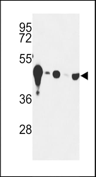 ENO2 / NSE Antibody (Tyr25)