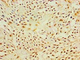 P4HA2 Antibody (aa236-535)