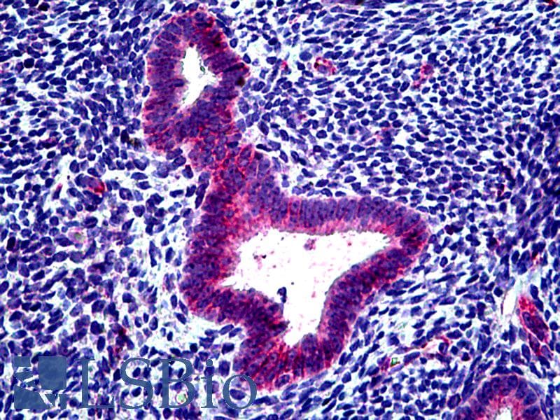 IHC-plus™ Polyclonal Goat anti-Human CLCN2 Antibody (aa738-751, IHC)