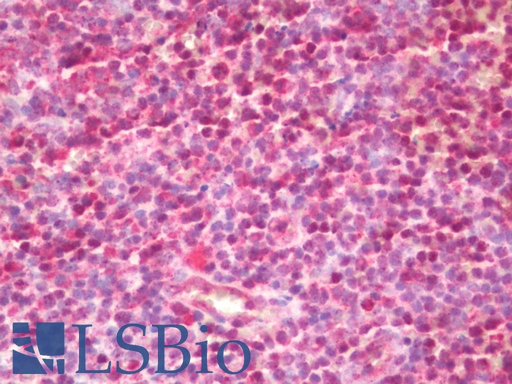 IHC-plus™ SLX4 Antibody (aa1784-1834)