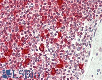 IHC-plus™ Polyclonal Rabbit anti-Human YBX1 / YB1 Antibody (aa224-274, IHC, WB)