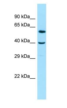 Polyclonal Rabbit anti-Human IK3-1 / CABLES1 Antibody (aa214-263, WB)