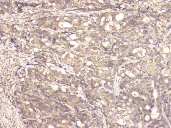 Polyclonal Rabbit anti-Human BMP15 Antibody (IHC, WB)