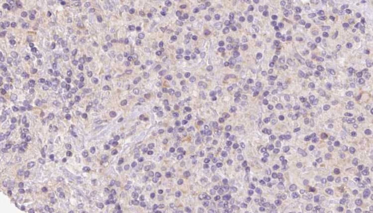 HERPUD1 / HERP Antibody