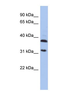 ASPA Antibody (aa143-192)