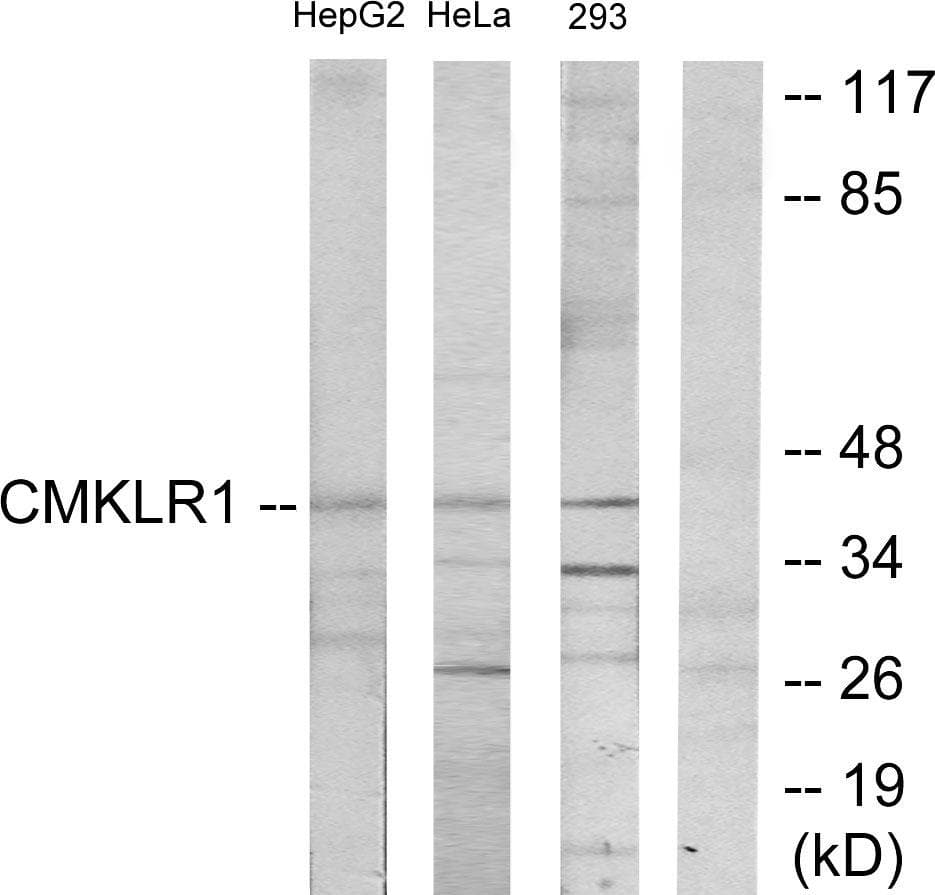 CHEMR23 / CMKLR1 Antibody