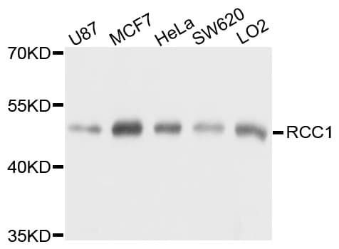 IHC-plus™ Polyclonal Rabbit anti-Human RCC1 Antibody (IHC, WB)