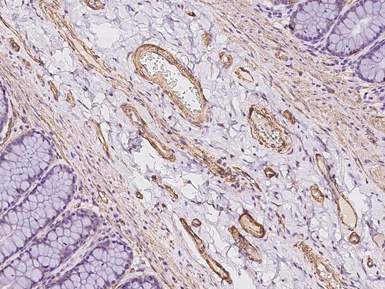 MAGEB10 Antibody