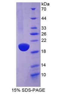 Mouse AQP4 / Aquaporin 4 Protein (Recombinant His)