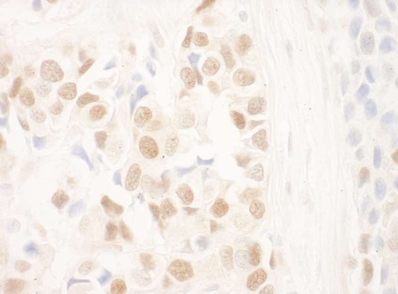 DCAF6 / NRIP Antibody (aa600-650)