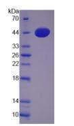Human Phospholipase D Protein (Recombinant His-S)