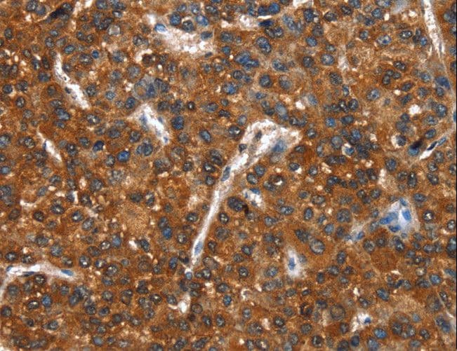 Polyclonal Rabbit anti-Human CTBP1 / CTBP Antibody (IHC, WB)
