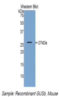 GUSB / Beta Glucuronidase Antibody (aa451-648, PE)