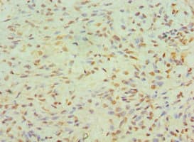 Polyclonal Rabbit anti-Human JMJD6 / PSR Antibody (aa1-320, IHC)