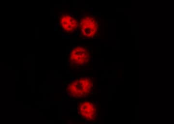 HNRNPD / AUF1 Antibody (phospho-Ser83)