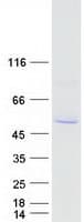 Human CYP2A7 Protein (Recombinant Myc-DDK (Flag))