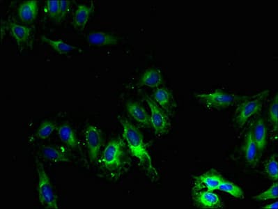 CYP2U1 Antibody