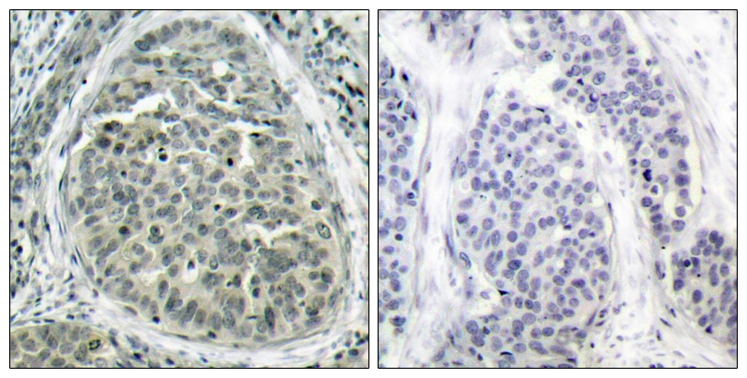 CTNNB1 / Beta Catenin Antibody (phospho-Ser62)